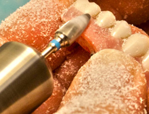 On-Site Provisionalization for Full Arch Implant Cases