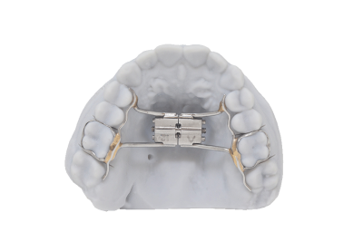 Hyrax Rapid Palatel Expander RDL | Russellville Dental Lab