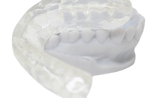 Russellville Dental Lab Dual Material Hard/Soft Occlusal Splint Michigan splint