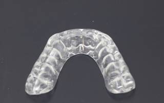 Russellville Dental Lab Occlusal Splint