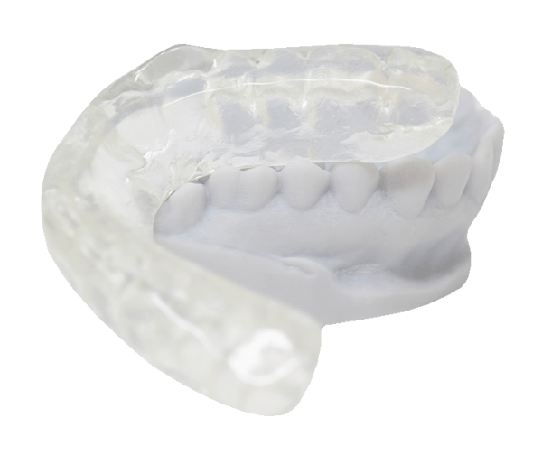 What Is A Occlusal Splint at Jerrell Shirley blog