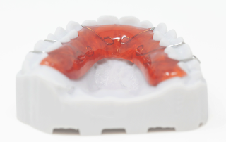Hawley Orthodontic Retainer Available from Russellville Dental Lab