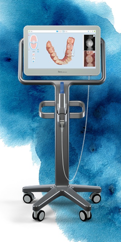 Scanner 3D intraoral - iTero® Element™ - Align Technology - para ortodontia  / para odontologia