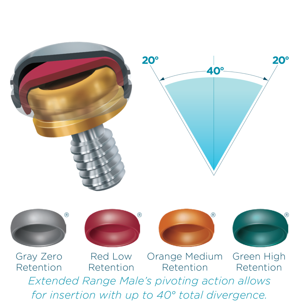 Zest Locator Abutments and Overdentures at RDL | Russellville Dental Lab