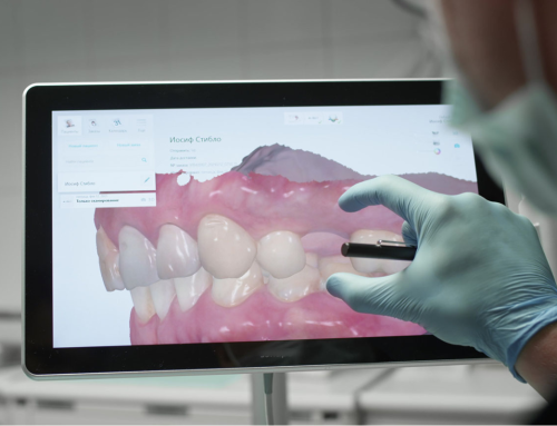 What the $%&# is a Digital Denture, really?